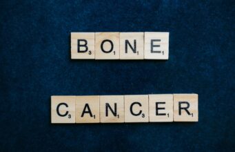Understanding the Causes and Risk Factors of Bone Cancer Bone Cancer