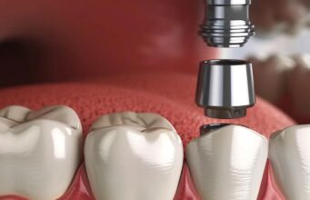 Transform Your Smile: The Impact Of Cosmetic Dentistry On Confidence Cosmetic Dentistry