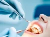 Common Myths About Dental Implants Debunked Dental Implants Debunked