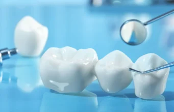 Understanding Fillings, Crowns, and Other Common Dental Restorations Dental Restorations