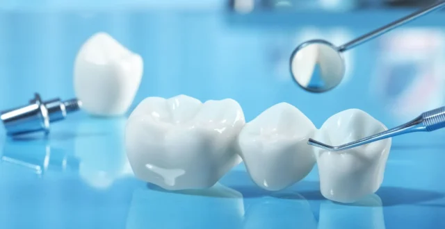 Dental Restorations