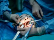 Understanding Common Dental Procedures for Families