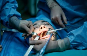 Understanding Common Dental Procedures for Families