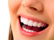 Smile Confidently: Blending Function And Beauty In Dental Treatment Dental Treatment