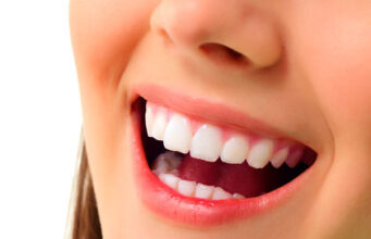 Smile Confidently: Blending Function And Beauty In Dental Treatment Dental Treatment