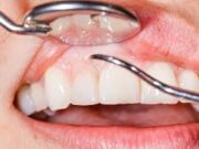 The Role Of A Periodontist In Managing Gum Disease Periodontist