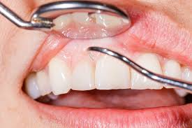 The Role Of A Periodontist In Managing Gum Disease Periodontist