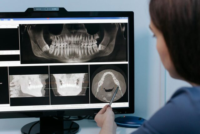 Orthodontic Screenings