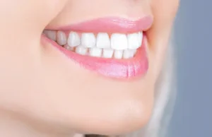Teeth Whitening After A Dental Cleaning: What You Should Know