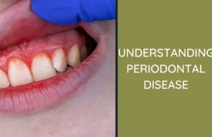 How Periodontal Disease Affects Your Overall Oral Health Periodontal Disease