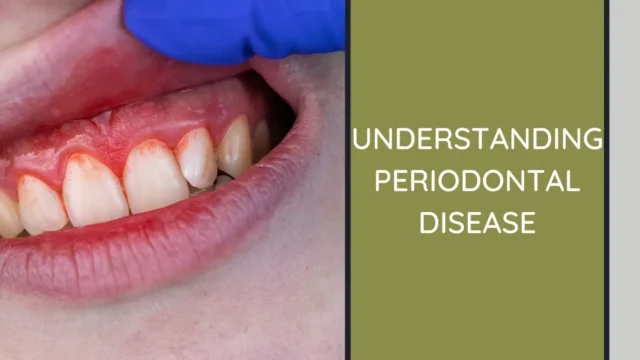 Periodontal Disease