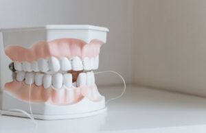 The Role Of Facial Structure In Choosing Between Dentures And Implants Dentures