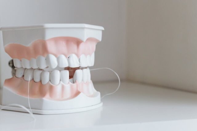 Dentures vs Implants: What Suits Your Face Best? Dentures