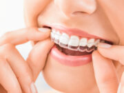 Why Orthodontic Care Is Essential For Children And Teens Orthodontic Care